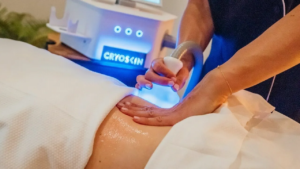 Cryoskin: The Future of Body Contouring and Sculpting